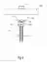 Fig. 07 - Ratchet locking mechanism for threaded fastener