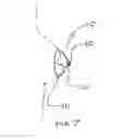 Fig. 04 - ILLUMINATED NIPPLE COVER