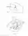 Fig. 06 - Protection device and methods