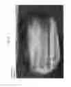 Fig. 05 - METHODS FOR PHENOTYPING OF INTACT BONES BY TISSUE CLEARING AND STAINING