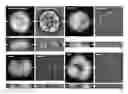 Fig. 01 - Methods for assessing cancer cells using granulometry