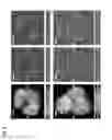 Fig. 05 - Methods for assessing cancer cells using granulometry