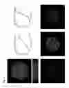 Fig. 06 - Methods for assessing cancer cells using granulometry