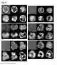 Fig. 07 - Methods for assessing cancer cells using granulometry