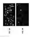 Fig. 03 - MICROFLUIDIC COLLABORATIVE ENZYME ENHANCED REACTIVE CEER IMMUNOASSAY
