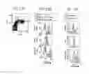 Fig. 18 - Detection and treatment of autoimmune disorders