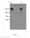 Fig. 19 - Microbial glycans as a target of human intelectin