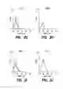 Fig. 05 - BCMA-BASED STRATIFICATION AND THERAPY FOR MULTIPLE MYELOMA PATIENTS