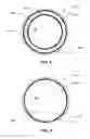 Fig. 05 - MRI SCANNER BORE COVERINGS
