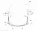 Fig. 01 - Wearable electronic device