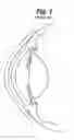 Fig. 02 - Partial corneal conjunctival contact lens