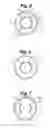Fig. 04 - Partial corneal conjunctival contact lens