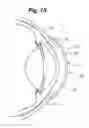 Fig. 12 - Partial corneal conjunctival contact lens