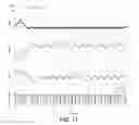 Fig. 11 - DITHER SWITCHING EXTREMUM SEEKING CONTROL