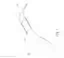 Fig. 02 - Heat dissipation structure of wearable watchstrap