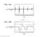 Fig. 14 - Electronic apparatus and method of detecting tap operation