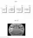 Fig. 02 - Apparatus and method for detecting object for vehicle