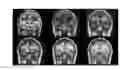 Fig. 01 - Method for rapid-multicontrast brain imaging