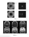 Fig. 04 - Method for rapid-multicontrast brain imaging