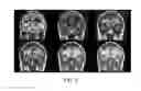 Fig. 05 - Method for rapid-multicontrast brain imaging