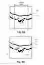 Fig. 09 - Robust segmentation of retinal pigment epithelium layer