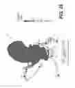 Fig. 15 - Method and system for image processing to determine patient-specific blood flow characteristics