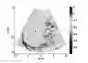 Fig. 01 - Acceleration and enhancement methods and system for ultrasound scatterer structure visualization