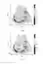 Fig. 08 - Acceleration and enhancement methods and system for ultrasound scatterer structure visualization