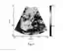 Fig. 09 - Acceleration and enhancement methods and system for ultrasound scatterer structure visualization