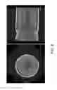 Fig. 09 - Radiation CT apparatus