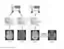 Fig. 01 - Method and system for unsupervised cross-modal medical image synthesis
