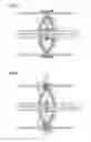 Fig. 03 - Insulating system and assembly method for an insulating system