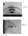 Fig. 05 - Methods of forming features