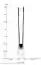 Fig. 28 - Method for ion implantation