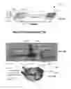 Fig. 10 - Multi-layer packaging scheme for implant electronics
