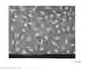 Fig. 11 - Method for producing an organic component and organic component comprising an arrangement of isolated metal particle nanoclusters