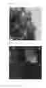 Fig. 09 - COMPOSITE HAVING METAL FLUORIDE AND POROUS CARBON, METHOD FOR PREPARING THE SAME, AND LITHIUM ION BATTERY COMPRISING THE SAME