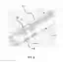 Fig. 05 - Laser direct structured connection for intravascular device