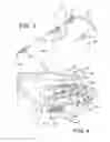 Fig. 03 - Laser device