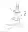 Fig. 07 - Laser device