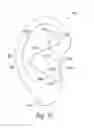 Fig. 03 - Earpiece attachment devices