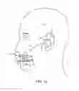 Fig. 03 - Apparatus, system and method for underwater voice communication by a diver