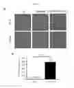 Fig. 06 - HUMANIZED MOUSE MODEL FOR STUDY OF BONA FIDE HEPATITIS VIRUS INFECTION AND USE THEREOF