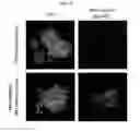 Fig. 20 - HUMANIZED MOUSE MODEL FOR STUDY OF BONA FIDE HEPATITIS VIRUS INFECTION AND USE THEREOF