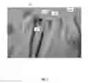 Fig. 02 - DEVICE AND SYSTEM FOR PAIRING SOCKS AND OTHER ARTICLES