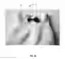 Fig. 08 - DEVICE AND SYSTEM FOR PAIRING SOCKS AND OTHER ARTICLES