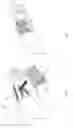 Fig. 03 - Detachable wrist coach