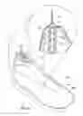 Fig. 10 - Method of using an inflatable member to customize an article