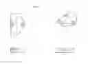 Fig. 04 - Easy release compound assemblies comprising a locking arrangement