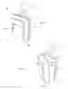 Fig. 04 - Side bound split trolley case